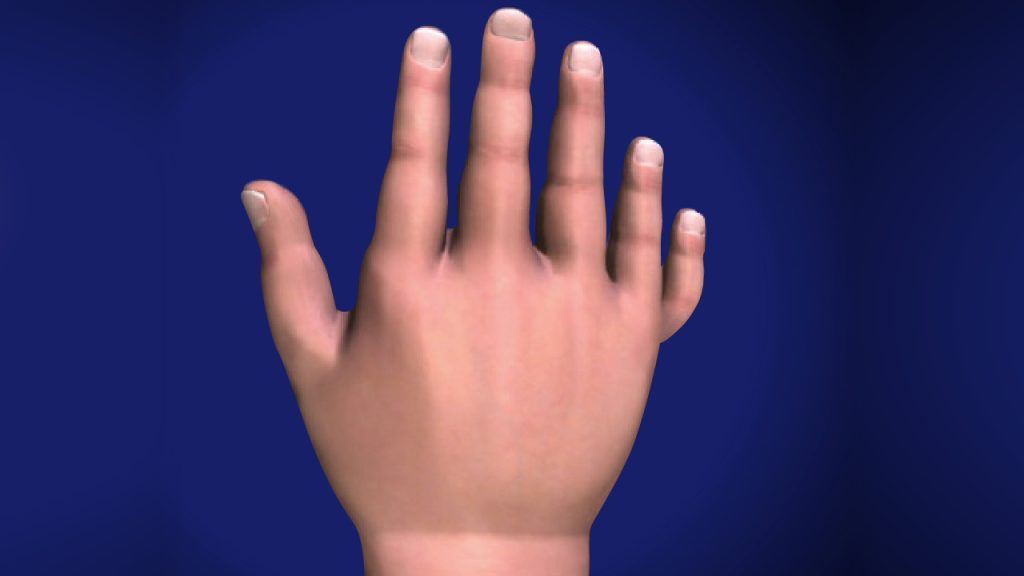 what-is-plastic-hand-surgery-a-detailed-explanation